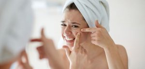 Lees meer over het artikel Oorzaken van puistjes (acne) – Feiten versus mythen